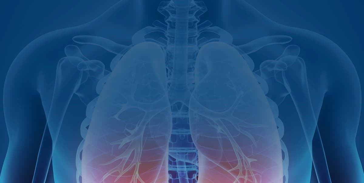 Lung Cancer