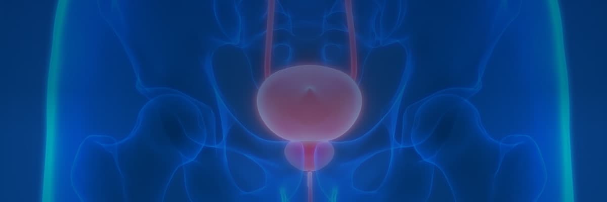Prostate Cancer